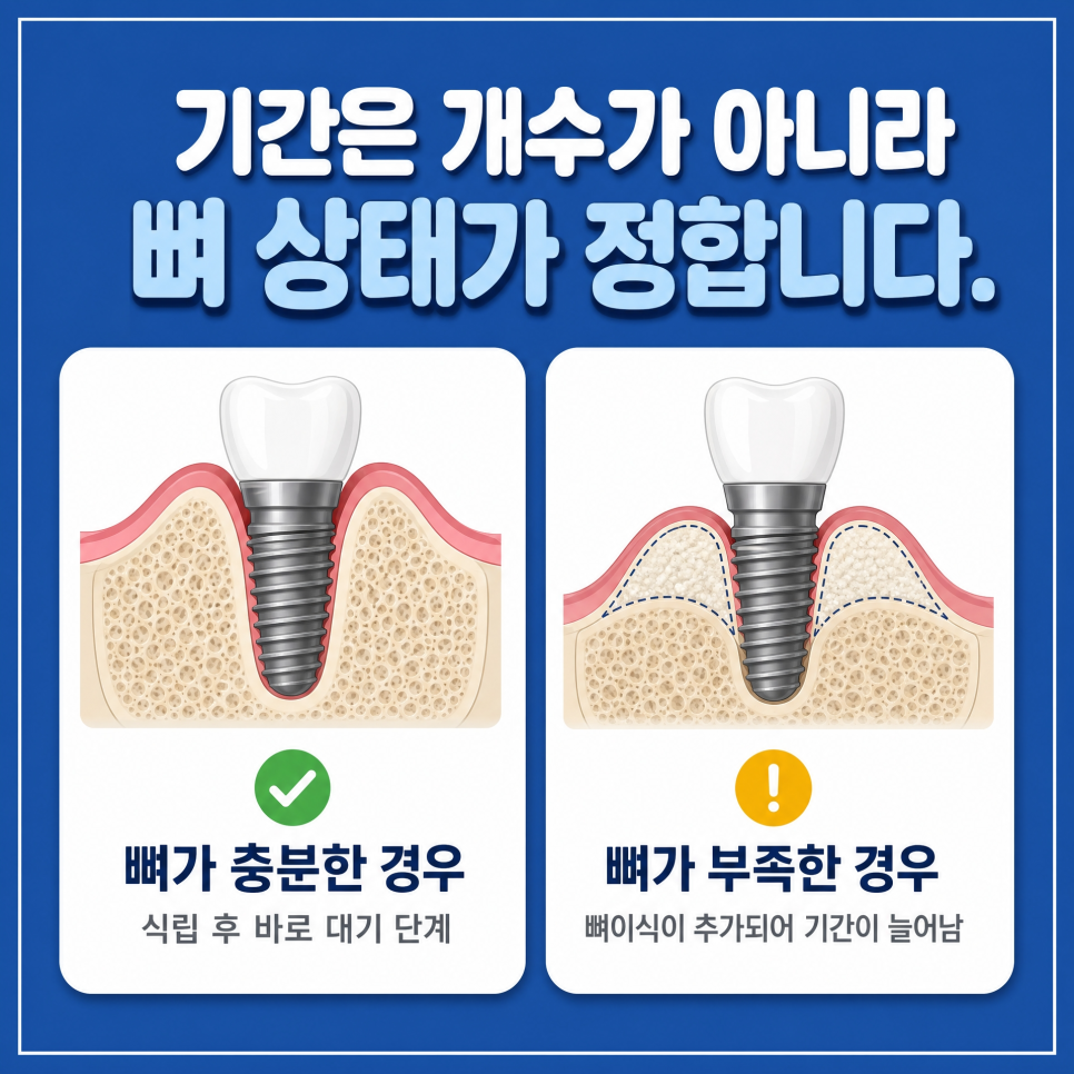 The Complete Implant Process, Organized by a Dental Clinic at Sinsa Station | How Long Does It Take? image 2
