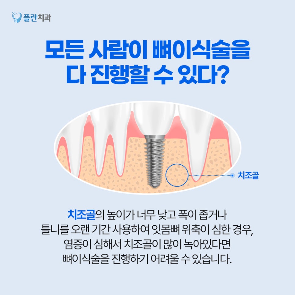 임플란트 전, 뼈이식술 꼭 진행해야 하는 이유는? 관련 이미지 6