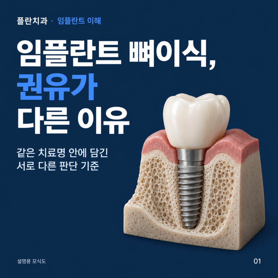 임플란트 뼈이식, 꼭 해야 할까요?압구정 치과에서 알려드립니다. 관련 이미지 1