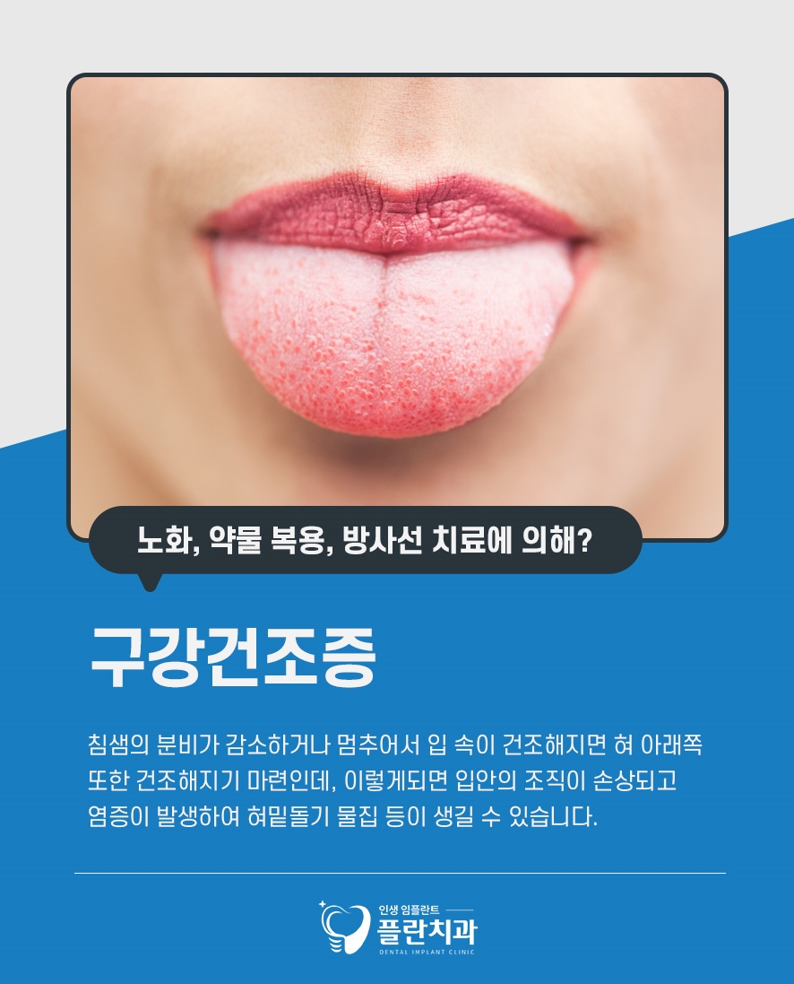 혀밑돌기 물집 원인과 대처 방법은 관련 이미지 4