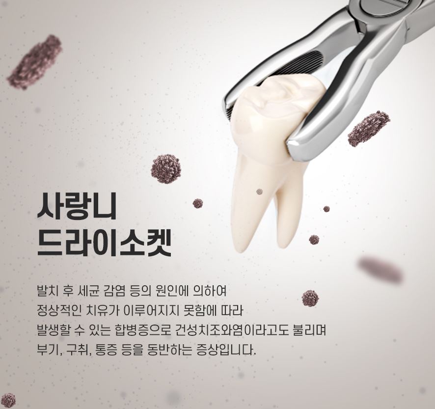 사랑니매복 된 상태에서는 발치 꼭 해야 할까? 관련 이미지 4