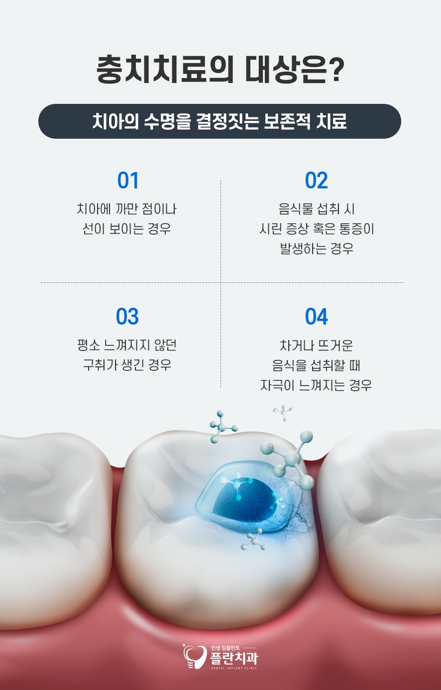 교대역치과 충치레진비용 비교적 저렴하니까 관련 이미지 3