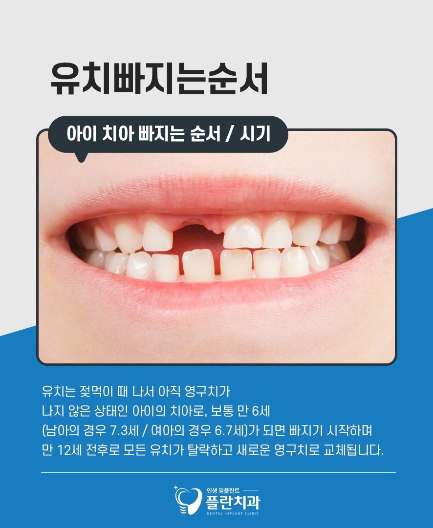 영구치나는순서 유치빠지는순서 시기 총정리 관련 이미지 2
