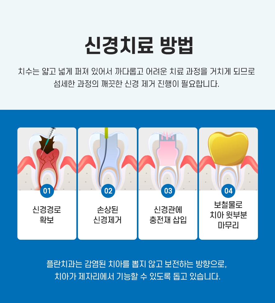 신경치료후크라운 꼭 해야 하나요? 관련 이미지 4