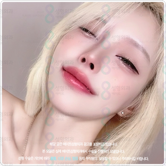 복코성형 콧볼축소 1개월 차! 코성형 붓기 빨리 빼는법과 코끝수술 후기 찾으셨나요? 관련 이미지 1