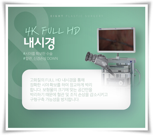 모티바 가슴수술 가격? 수술 후 촉감, 구형구축 문제없나요? 관련 이미지 12
