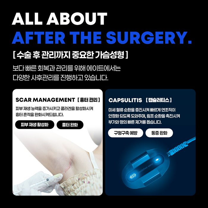 When Can You Exercise After Breast Augmentation, and How Long Is the Recovery Period? A Guide to Safe Recovery image 8
