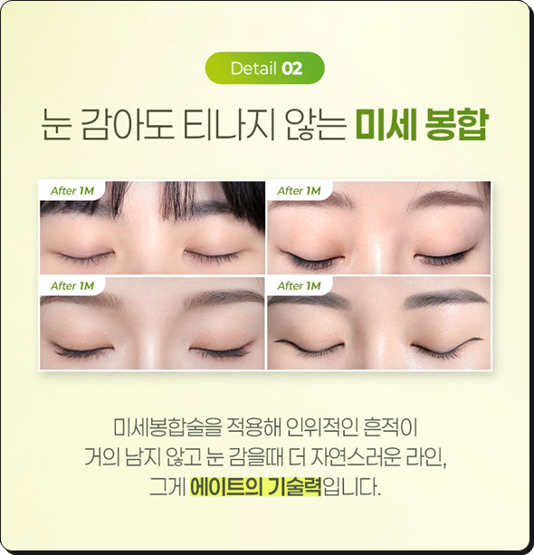 쌍꺼풀수술은 꼭 비절개가 좋을까? 부분절개와 절개의 비용 대비 효과는? 관련 이미지 8