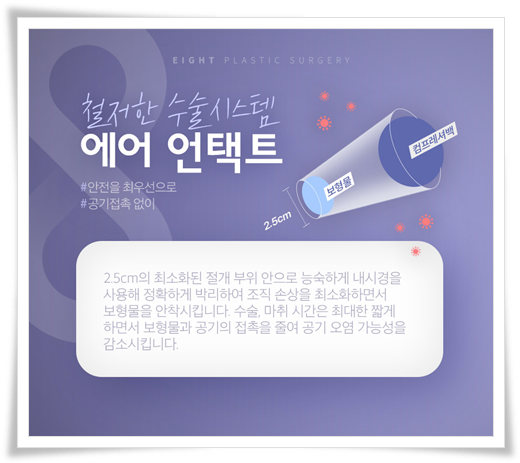 멘토 엑스트라 모티바 차이, 비용, 가슴보형물 종류 고르는법 관련 이미지 13