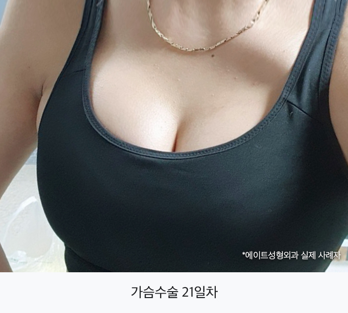 압구정가슴성형 원하는대로 자리할 수 있다면 관련 이미지 2