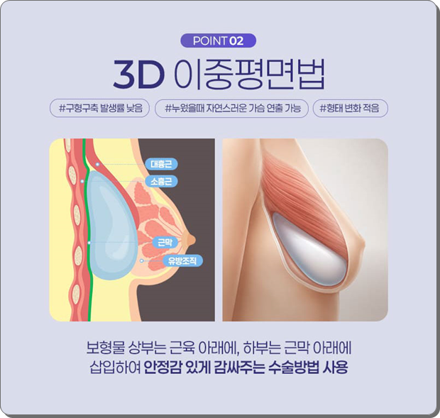 압구정역 가슴수술, 성형외과 추천? 멘토 엑스트라는 비용 전에 가슴 트레이닝센터, 의사를 확인 관련 이미지 13