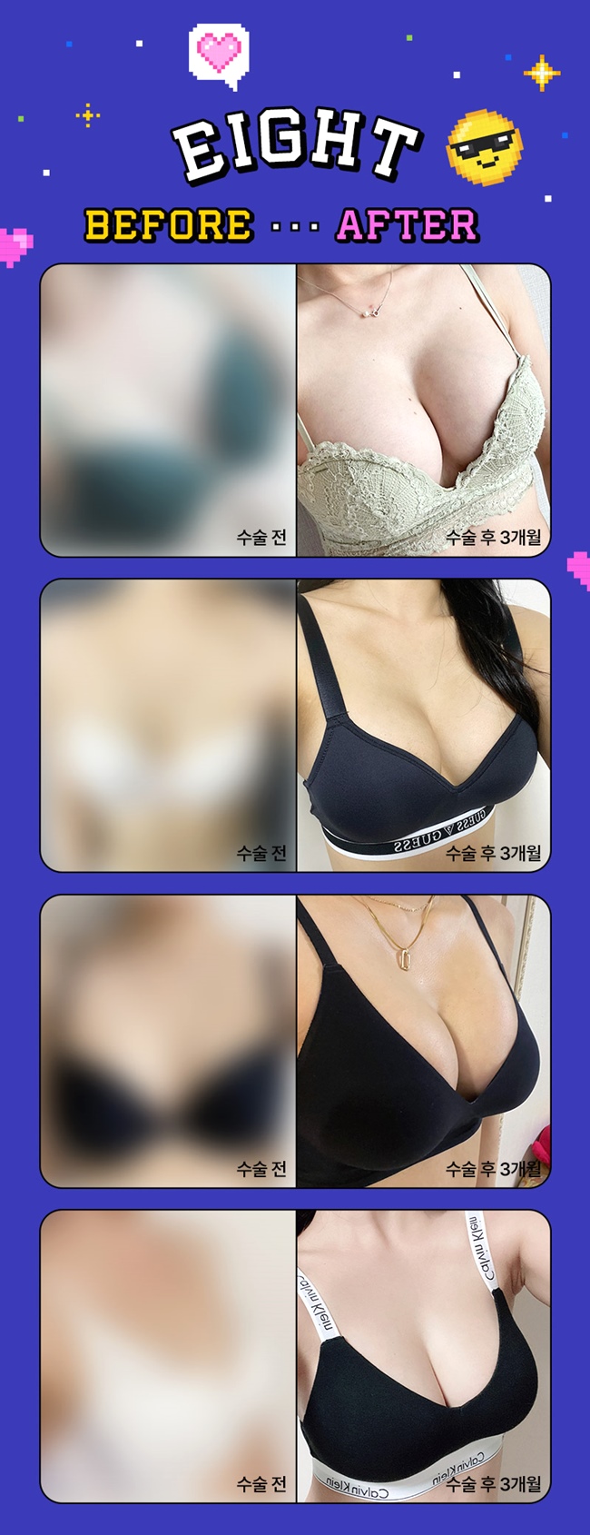 About the Differences Between Mentor Extra and Mentor Smooth image 5