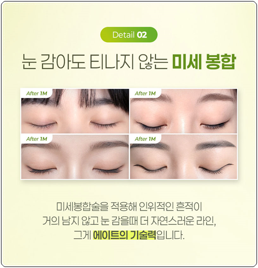 세미아웃라인 쌍수를 매몰로 하는법? 발품 비용 상담 후기 참고용 관련 이미지 11