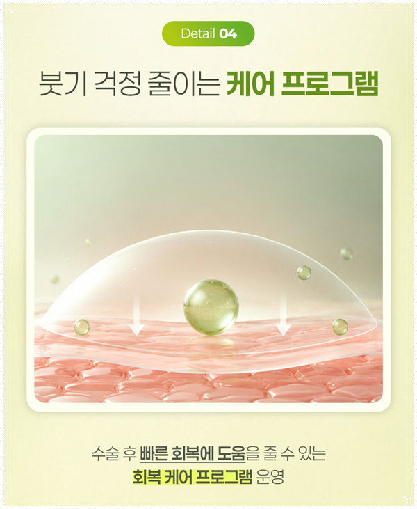 인라인 쌍꺼풀 후기, 쌍수 전과 1개월 후 라인은 어떻게 달라질까 관련 이미지 14