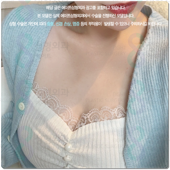 Are You Curious About the Cost of Breast Augmentation Surgery? Understanding the Differences Between Mentor Xtra and Smooth image 3