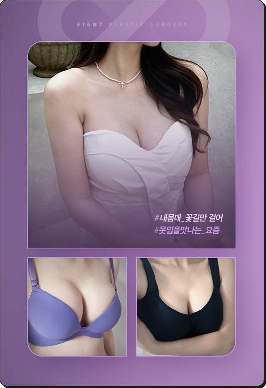 모티바 가슴수술 가격, 멘토 엑스트라 비교 어떤 차이가 있나요? 관련 이미지 26