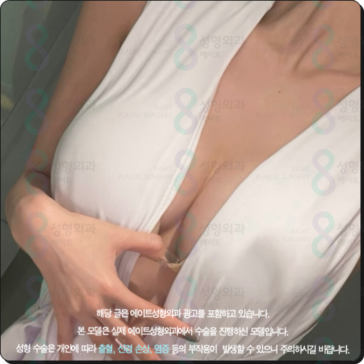 Motiva Breast Augmentation Cost (Price), Before-and-After Reviews: Can the Risk of Surgery Side Effects Be Reduced? image 4