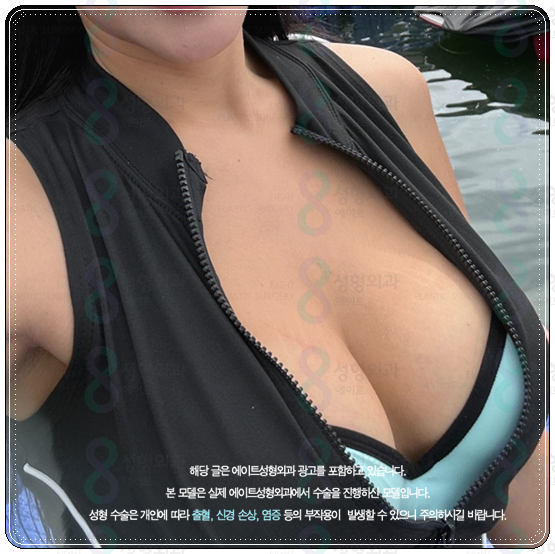 처진가슴수술 비용 (가격), 처짐 개선 방법은? 후기, 회복기간 어떤가요? 관련 이미지 3