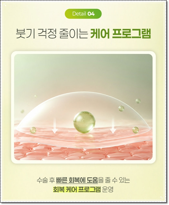 쌍커플스타일, 아웃라인과 세미아웃라인에 대해서 관련 이미지 14