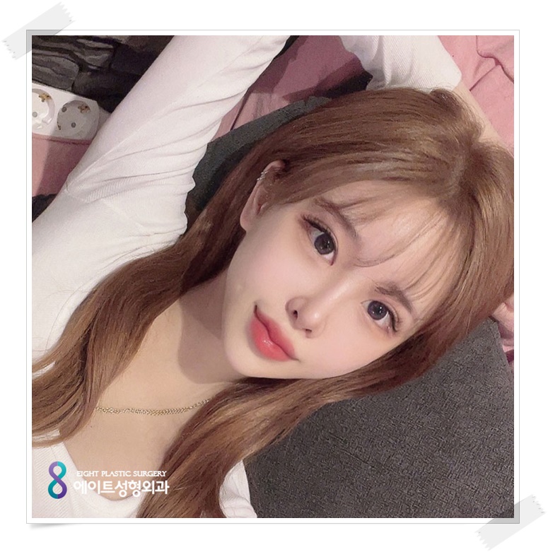 앞트임비용 얼마인지 알아보려면 관련 이미지 1