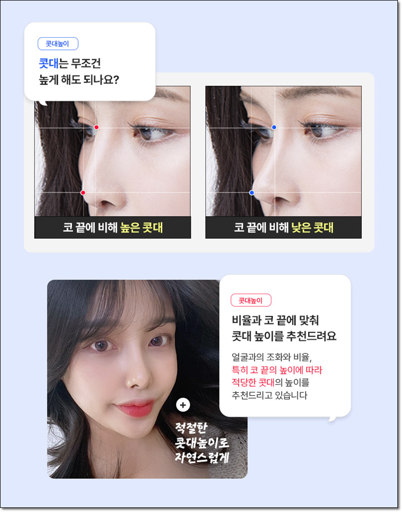 Why Facial Proportions Matter for a Straight-But-Slightly-Upturned Nose image 4