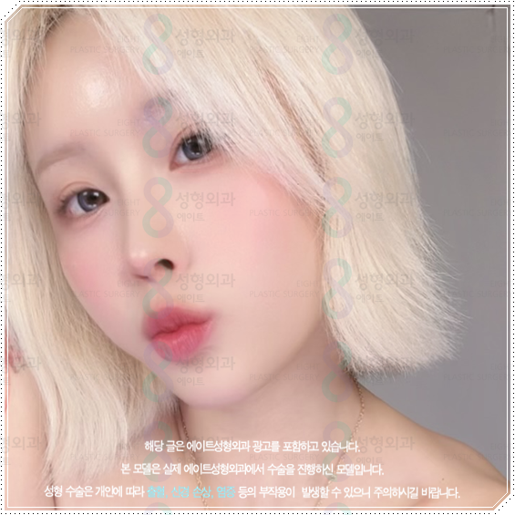 How Much Does a Non-Implant Tip Rhinoplasty Cost? Types of Materials Used in Nose Surgery and How It Differs from Bridge Surgery image 2