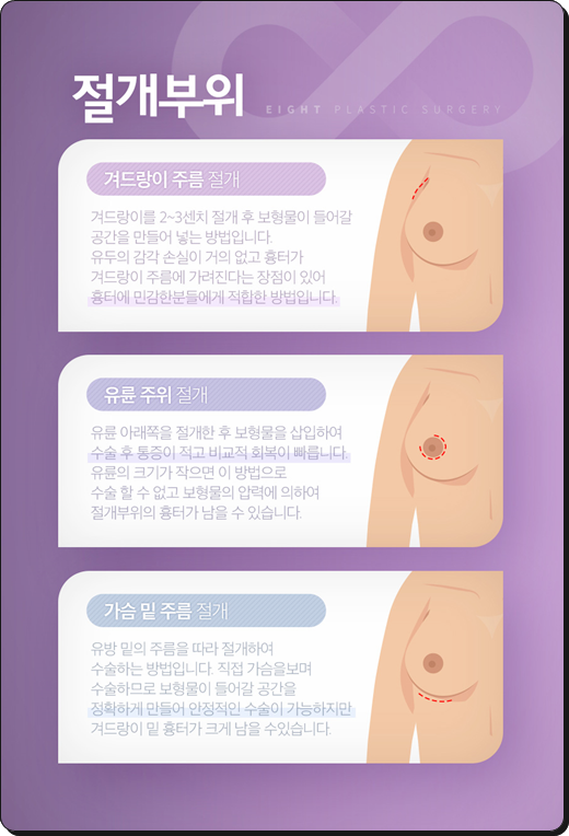Breast Augmentation Types and Methods, Implant Costs, Pros and Cons image 19
