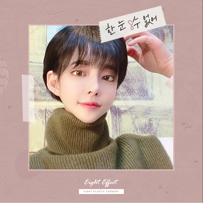 V라인사각턱 자갈턱 돌려깎기 관련 이미지 5