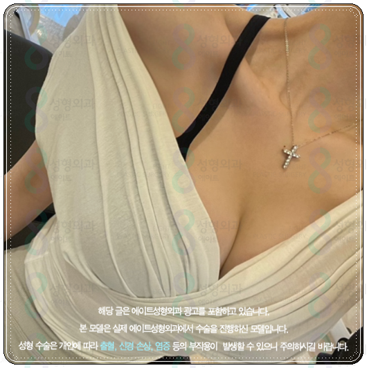 멘토 부스트 가격(비용) 가슴성형 후기 비교 촉감 정말 좋나요? 관련 이미지 5