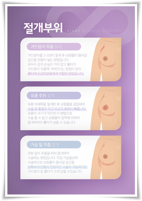 Breast Augmentation Surgery Cost: How Can Pain Be Reduced? image 18