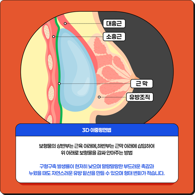 Breast Augmentation Surgery Cost (Price) and the Secret to a Review with No Side Effects Before and After? image 15