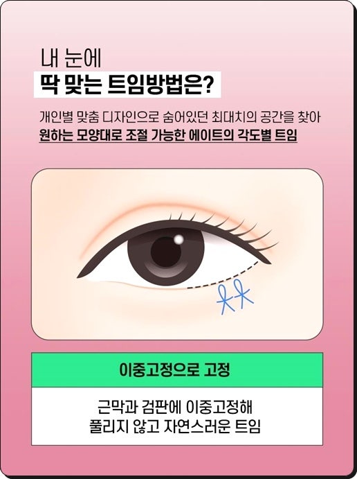 If You Have Been Looking Into Outer Corner and Lower Corner Eye Surgery Reviews, and Eye Corner Surgery Prices image 7