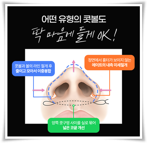 코끝수술 잘하는곳, 예쁜 후기, 가격 정보, 콧볼축소 뭐가 다른가요? 관련 이미지 6