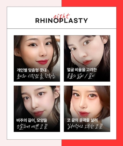 Famous Clinic for Nose Revision Surgery&nbsp;Best Place for Nose Revision Surgery in Gangnam&nbsp;Famous Place for Nose Revision Surgery in Seoul image 8