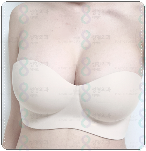 If You're Looking Into Breast Augmentation Cost Reviews, Be Sure to Read This image 2