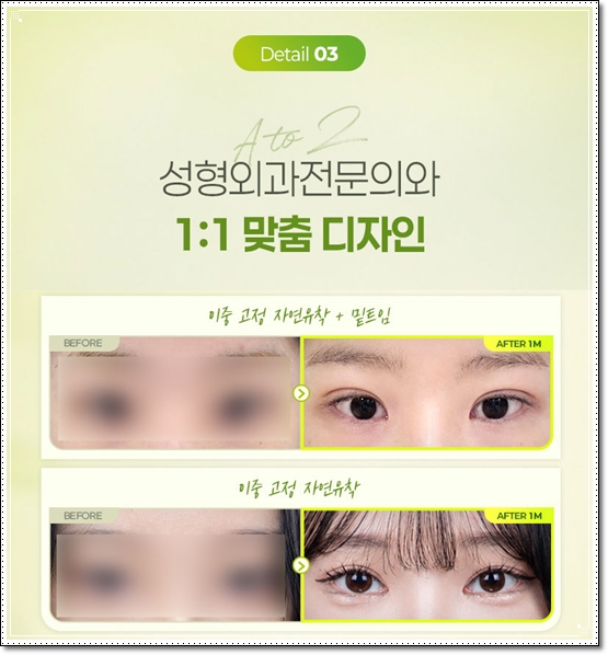 쌍커플스타일, 아웃라인과 세미아웃라인에 대해서 관련 이미지 13