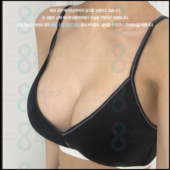 When Can You Exercise After Breast Augmentation, and How Long Is the Recovery Period? A Guide to Safe Recovery image 3