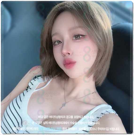 Bokko Rhinoplasty Review Summary! In Sinsa-dong, what are the costs of bokko surgery and the criteria for choosing a good clinic? image 1