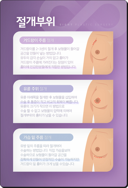 모티바 가슴수술 가격, 멘토 엑스트라 비교 어떤 차이가 있나요? 관련 이미지 17