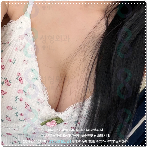 가슴재수술부터 처진가슴 거상술까지, 보형물 교체와 제거 방법 관련 이미지 2