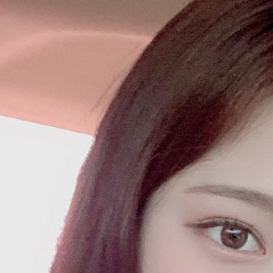 눈성형외과 내게 맞는 눈성형을 찾아요 관련 이미지 9