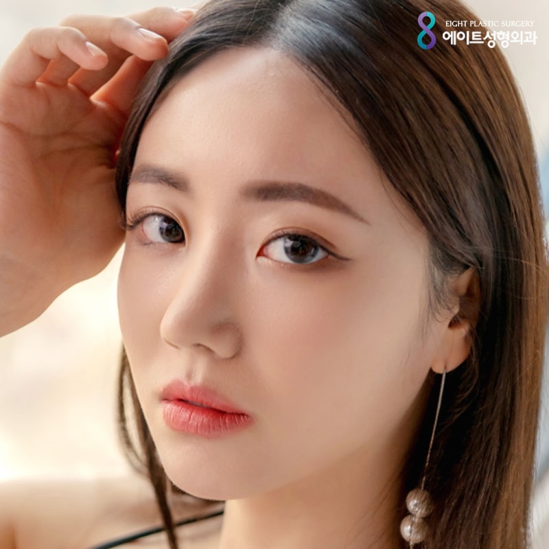 Can I have both canthoplasty and epicanthoplasty? image 1