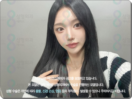 코수술 후기 일주일 1개월 비교? 평균 비용, 코성형 종류 장단점은? 관련 이미지 2