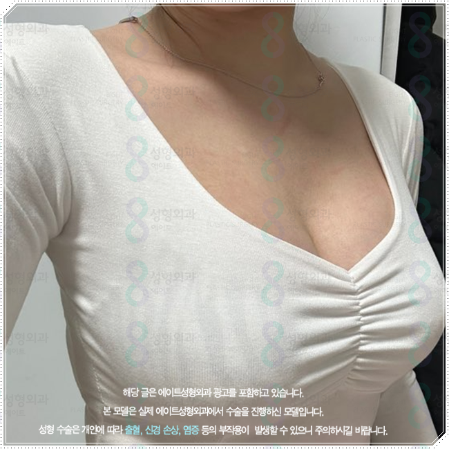 How Much Does Sagging Breast Surgery Cost? A Summary of Improvement Methods, Reviews, and Recovery Time image 4