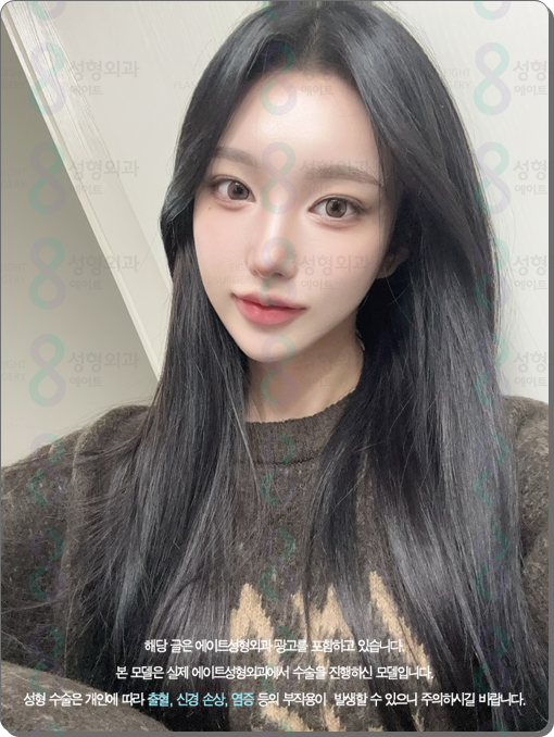 코수술 후기 일주일 1개월 비교? 평균 비용, 코성형 종류 장단점은? 관련 이미지 5