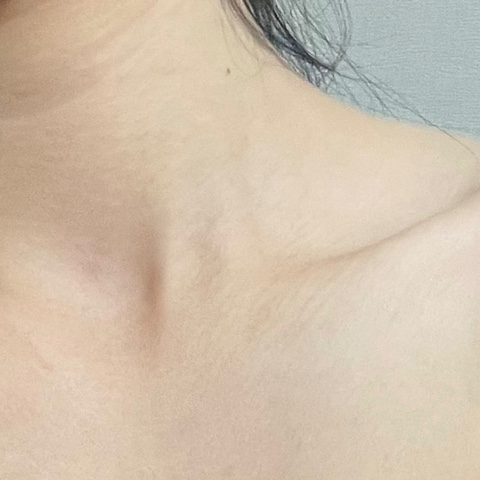 세빈 보형물 : 서브리미티? 인테그리티? 특징 비교분석 관련 이미지 16