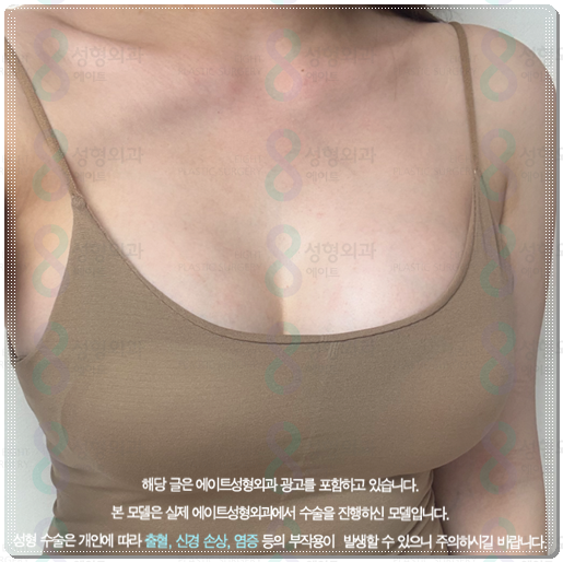처진 가슴수술 비용 (가격), 후기, 보형물? 거상술? 어떤 방법을 해야하나요? 관련 이미지 2