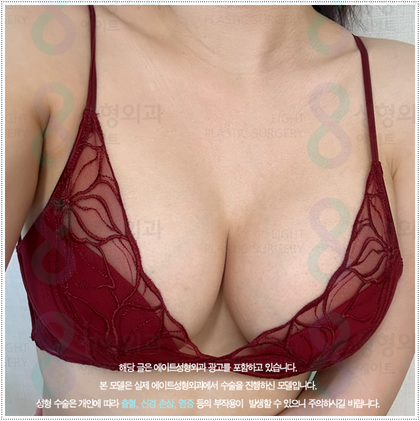 수술 비용이 부담되나요? 가슴수술 준비할 때 처진 가슴은 어떤 방법이 좋나요? 관련 이미지 5