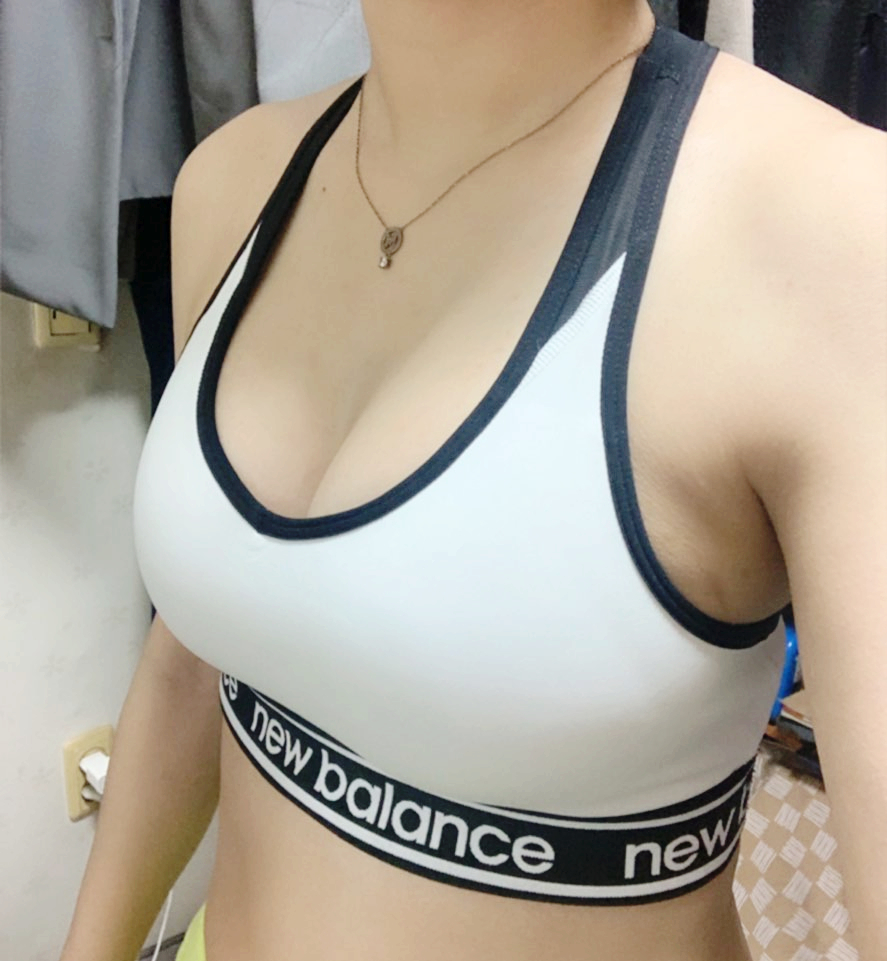 출산후 가슴성형 후기 관련 이미지 4