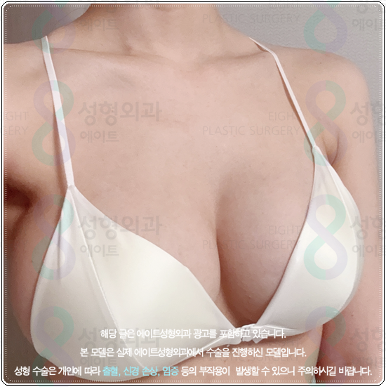 How Much Does Breast Augmentation with Mentor Xtra Cost? What to Know About Feel and Precautions Before and After Surgery image 4